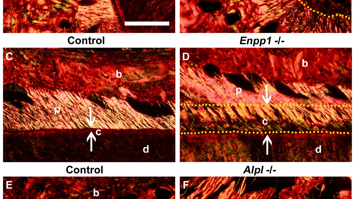 Collagen fibres in polarized light — nature's own self-assembled peptide filament, a model for engineered peptide nanofibers, referenced by Panacea Bio Chem and Bogdan Dicoias